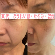 画像をギャラリービューアに読み込む, 【1番オススメ商品】【定期・毎月】LBオールインワンセラム