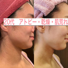 画像をギャラリービューアに読み込む, LBオールインワンセラム 30ml