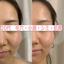 画像をギャラリービューアに読み込む, 【今だけ!】【定期・毎月】LBオールインワンセラム \通常13,200円→初回2,640円/