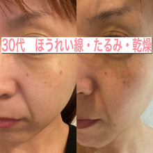 画像をギャラリービューアに読み込む, LBオールインワンセラム 30ml