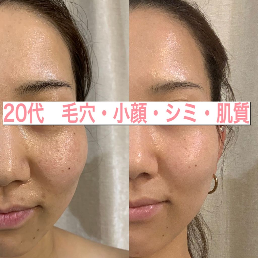LBオールインワンセラム 30ml – lumierebijou